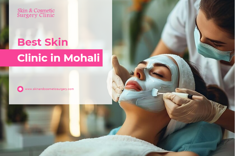 skin clinic in Mohali