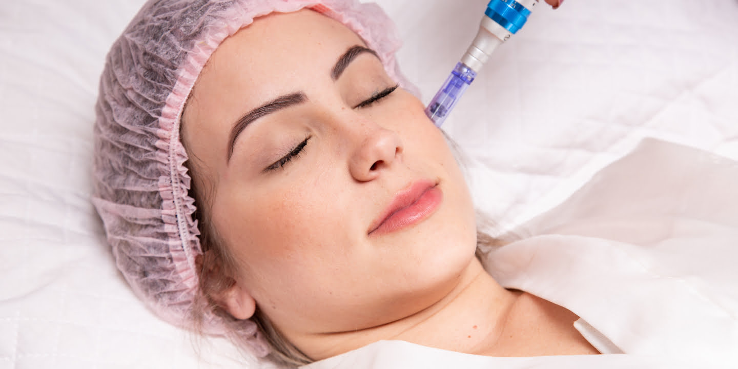 Dermapen-Microneedling-Treatment