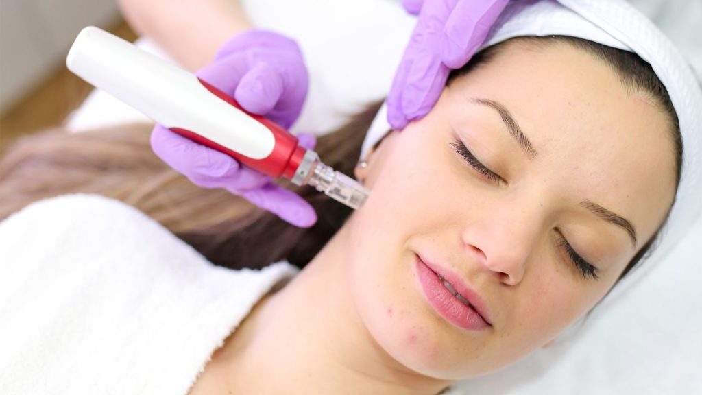 Microneedling-facial