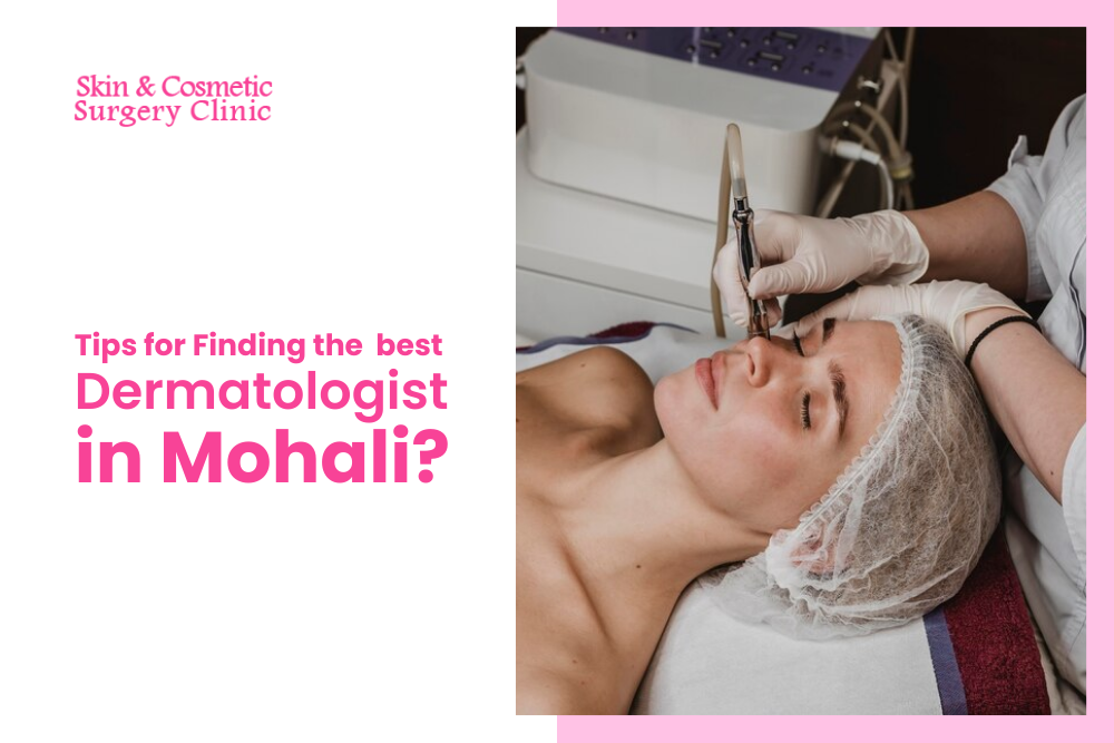 Why Should You Consult The Best  Dermatologist in Mohali?