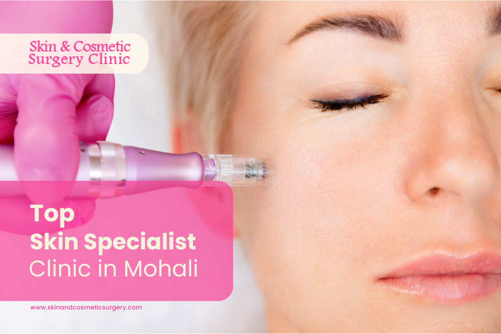 Top 5 Skin Specialists in Mohali 