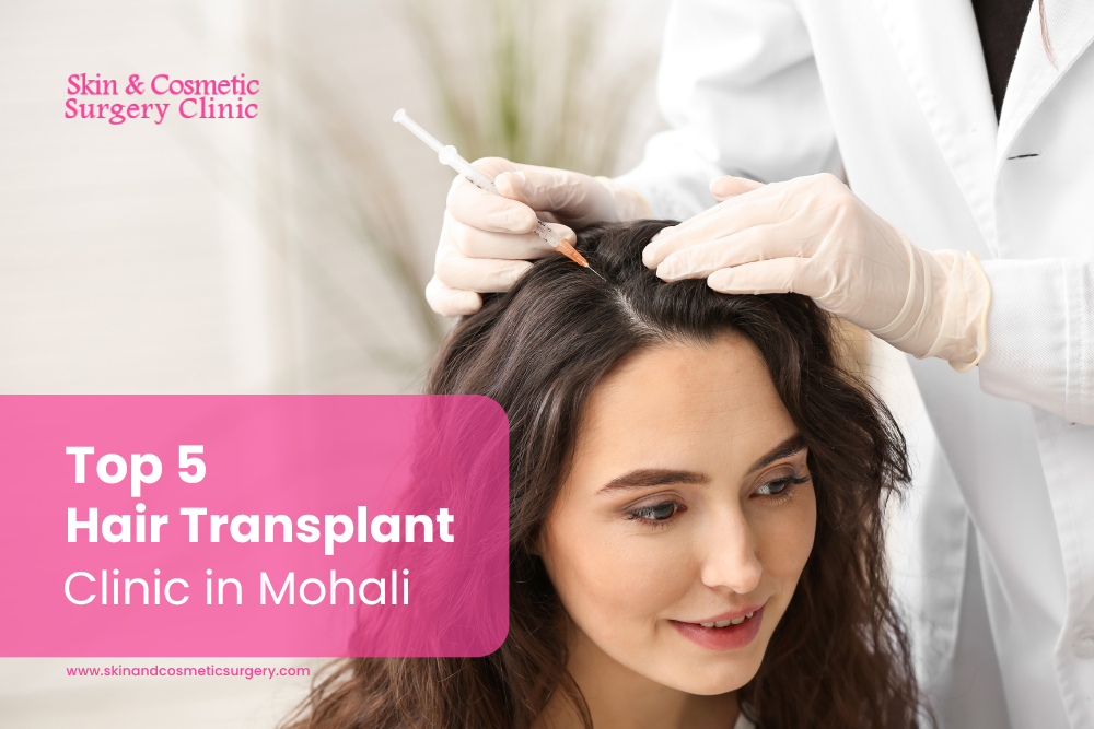 Top 5 Hair Transplant Clinics in Mohali