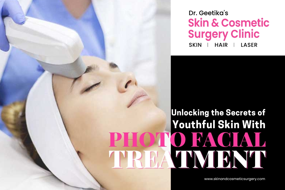 Unlocking the Secrets of Youthful Skin With Photo Facial Treatment