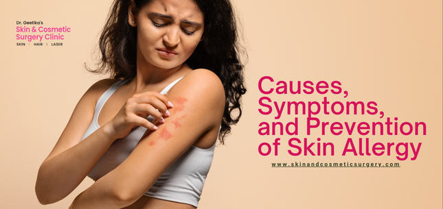 Causes, Symptoms, and Prevention of Skin Allergy