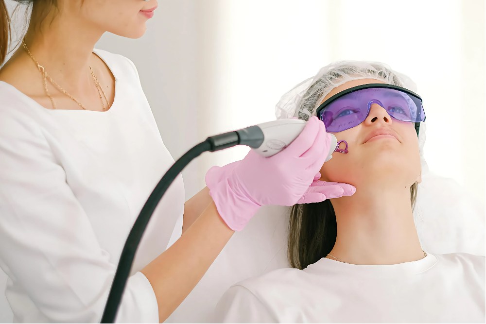 laser-treatment skin-treat