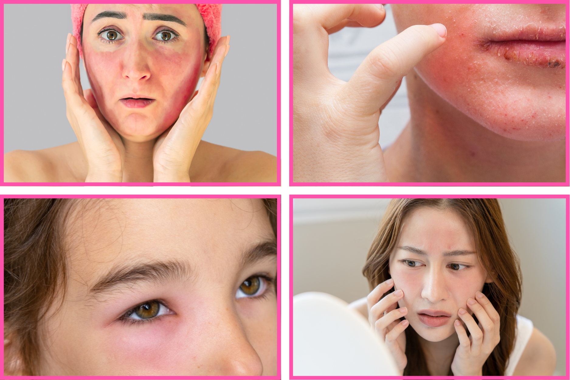 skin-alergies treatment-skin