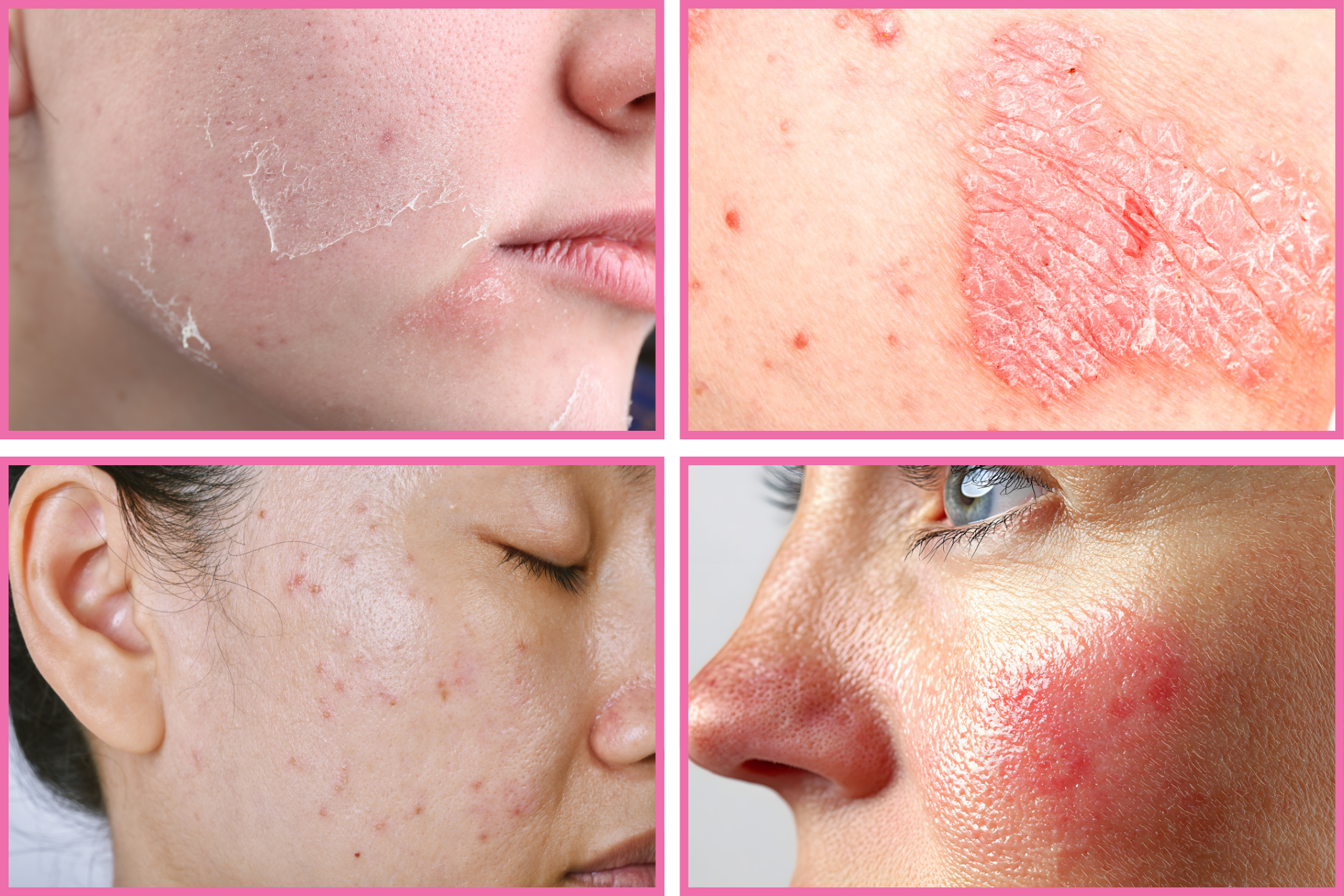 treatment-skin