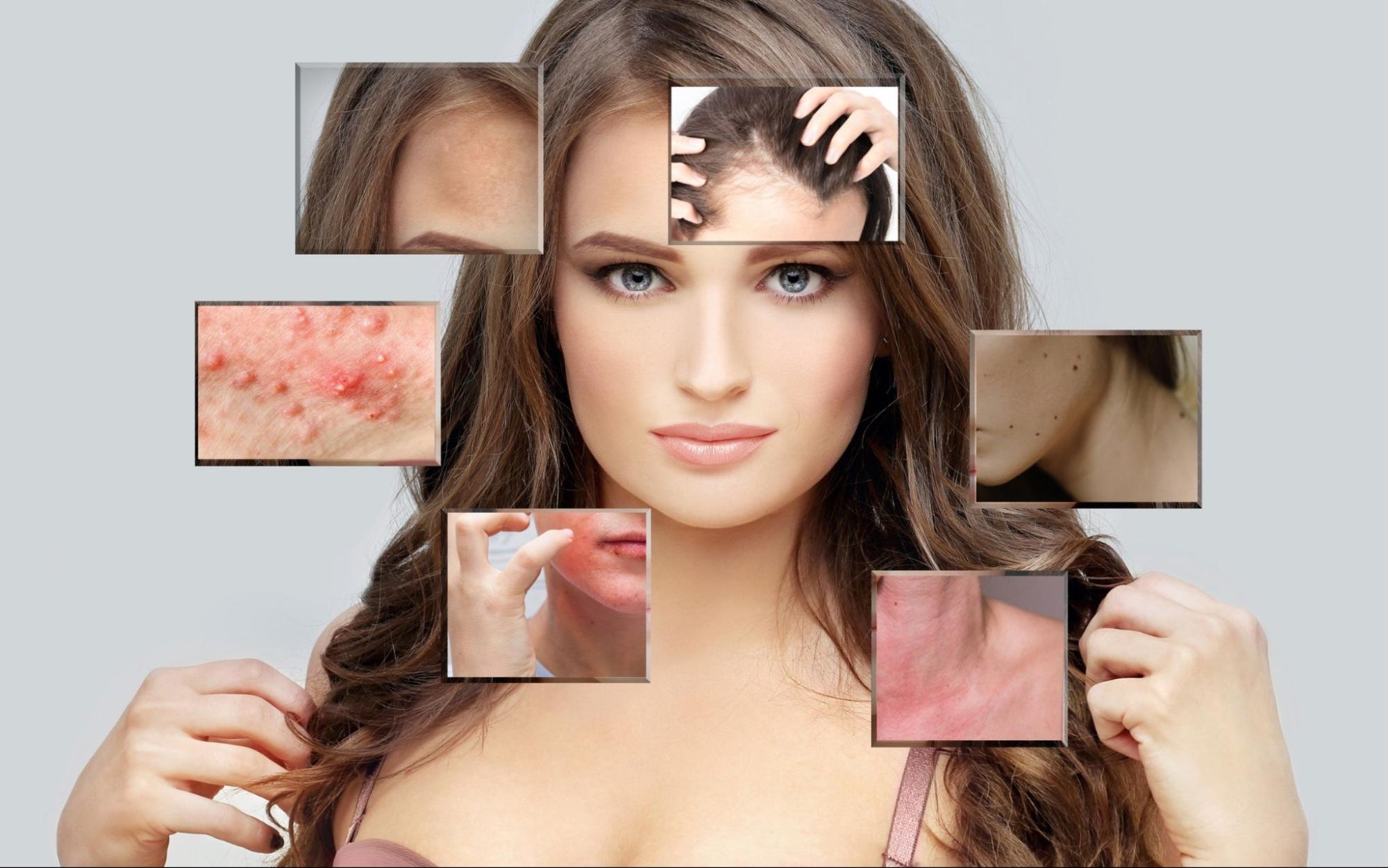 skin-problems Skin Specialist