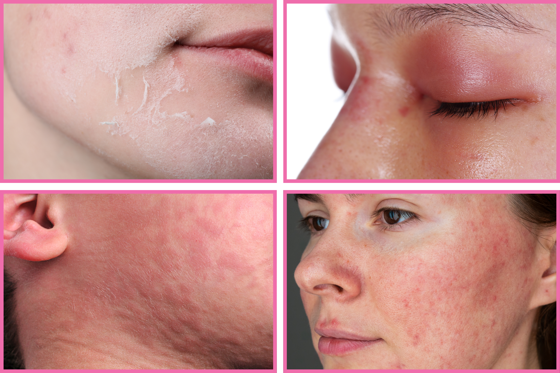 skin-problems treatment-skin