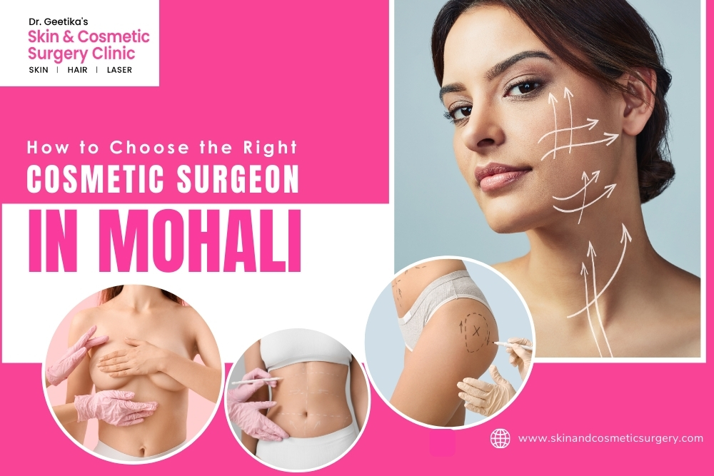 How to Choose the Right Cosmetic Surgeon in Mohali: Tips and Considerations