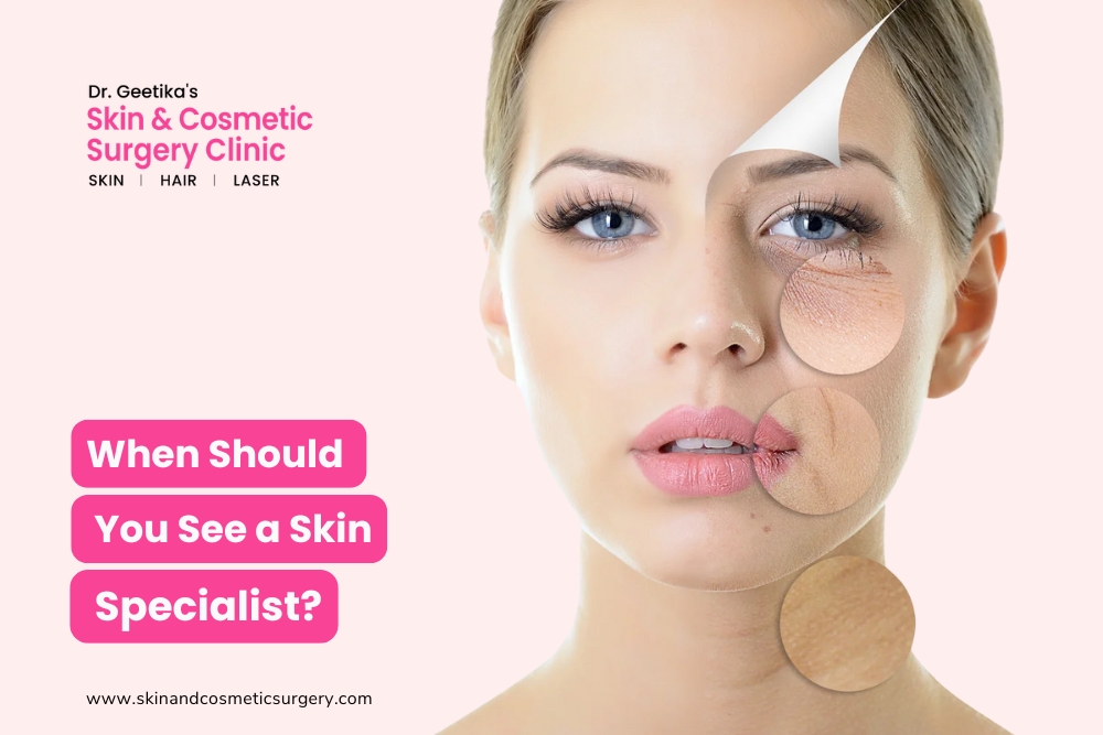 When Should You See a Skin Specialist?