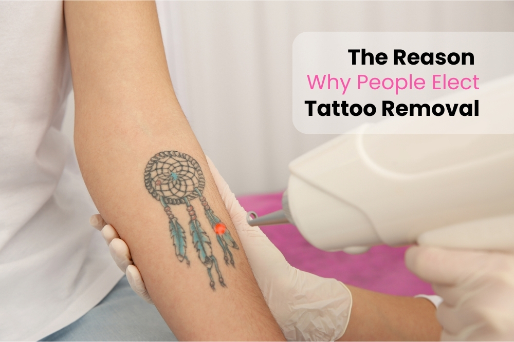 The Reason Why People Elect Tattoo Removal
