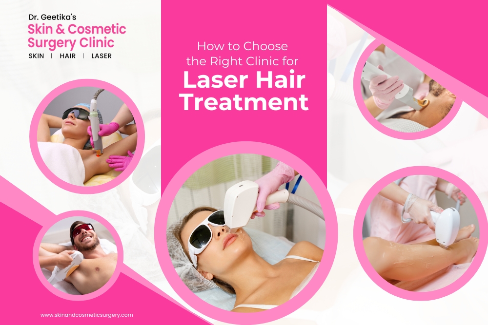 How to Choose the Right Clinic for Laser Hair Treatment