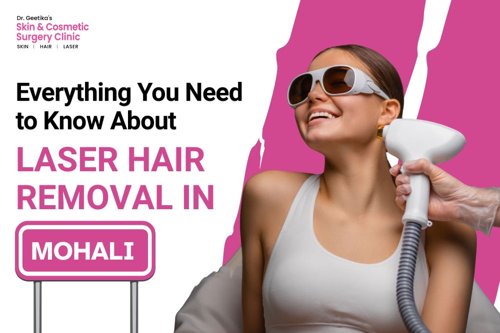 Everything You Need to Know About Laser Hair Removal in Mohali