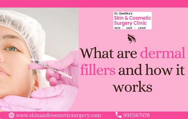 What are Dermal Fillers and how it Works