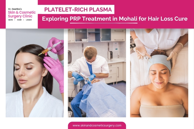 Platelet-Rich Plasma: Exploring PRP Treatment in Mohali for Hair Loss Cure