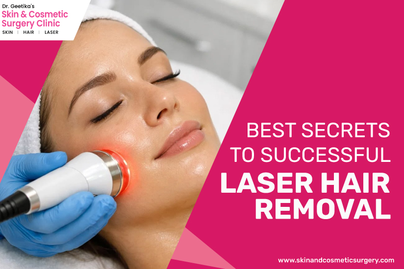 Best Secrets to Successful Laser Hair Removal