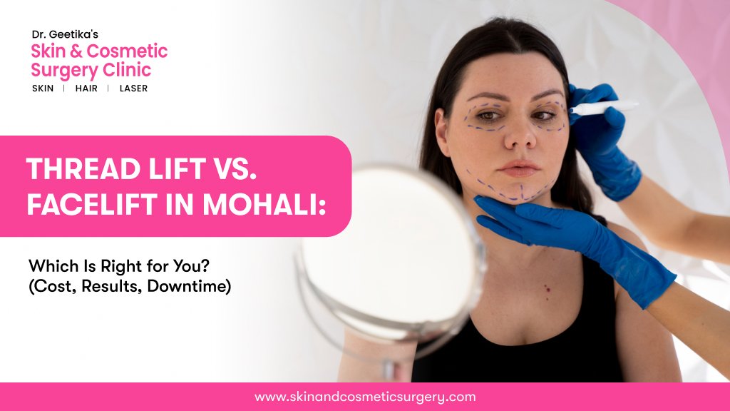 Thread Lift vs. Facelift in Mohali: Which Is Right for You? (Cost, Results, Downtime)